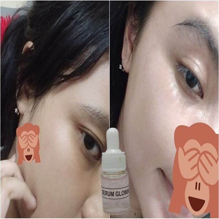 SERUM Glowing 10ML Pencerah Wajah Glowing Original BPOM Serum ...