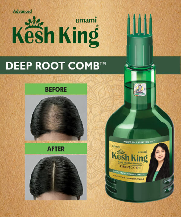 kesh-king-ayurvedic-medicinal-oil-100ml-free-shampoo-50-ml