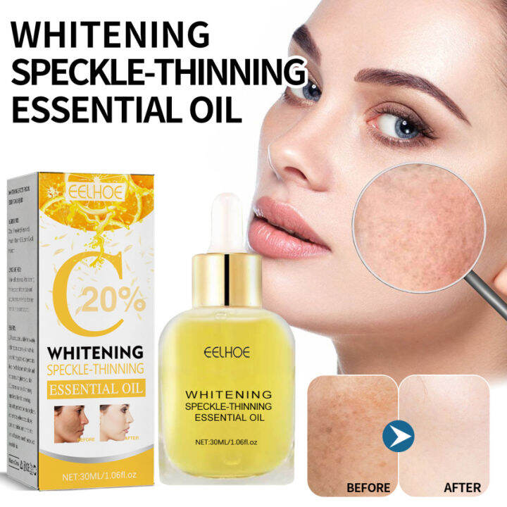 Body Dark Spot Remover Skin Spot Whitening Remove Facial Dark Spots