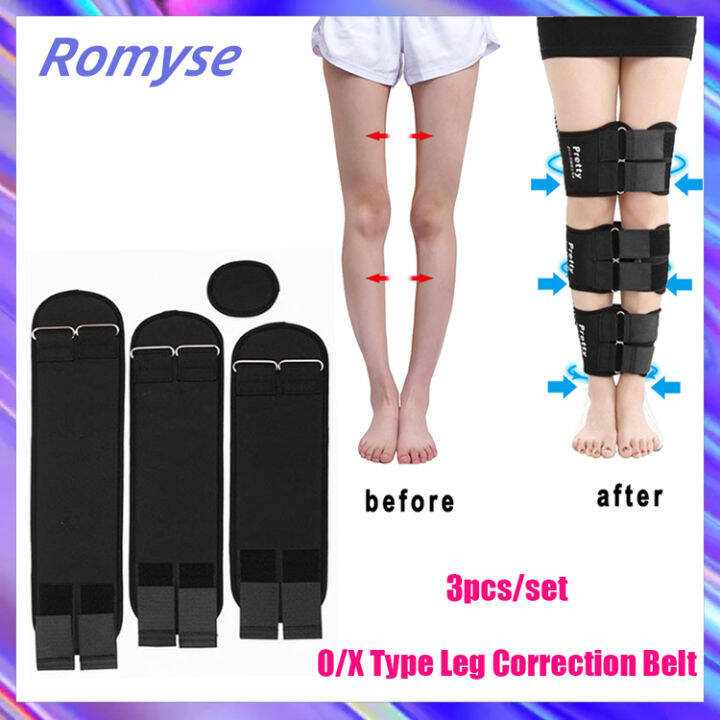 Romyse 3Pcs Effective O/X Type Leg Correction Band Belt Bowed Legs Knee ...