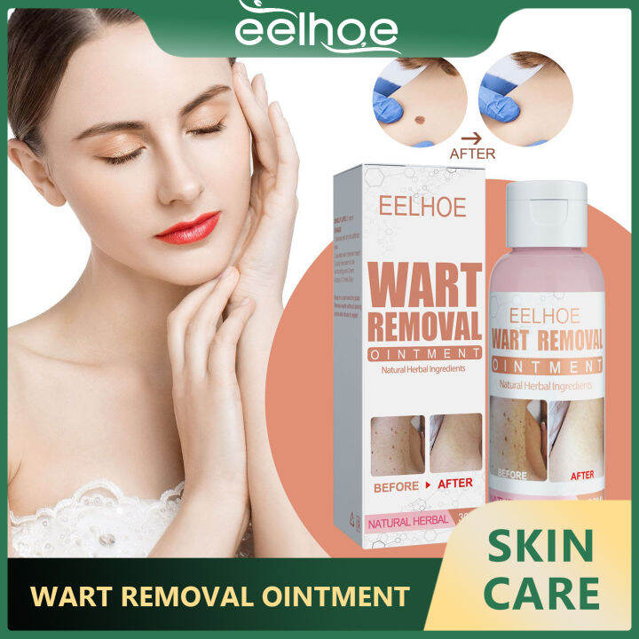 Eelhoe Wart Removal Body Cleansing Cream Excellent Wart Skin Repair And 