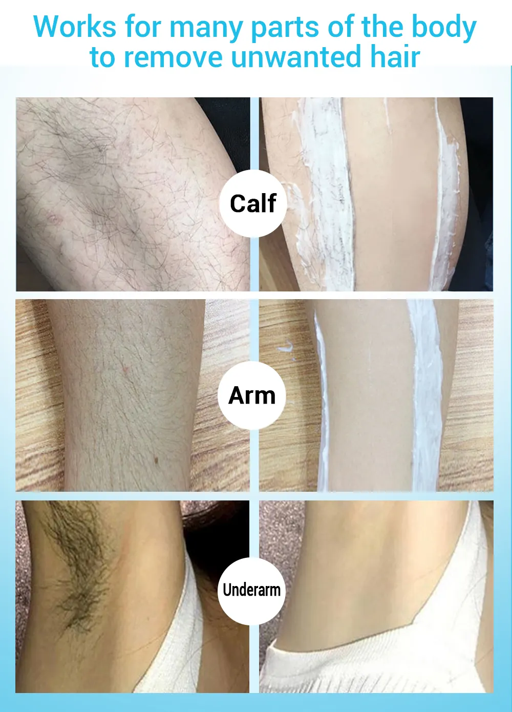 LANBENA Hair Removal Cream Leg/Underarm Painless Hair Remover Gentle  Depilation Not Stimulating Effective Epilator Nourishing Repairing Body  Care | Lazada PH