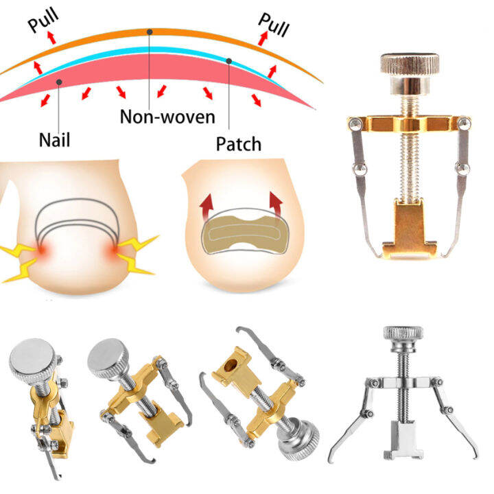 1ชิ้นนิ้วเท้าเล็บแก้ไขสำหรับการรักษาคุดเล็บเท้าเล็บกู้คืนหนีบสแตนเลส-paronychia-ยกเท้าดูแลเครื่องมือ