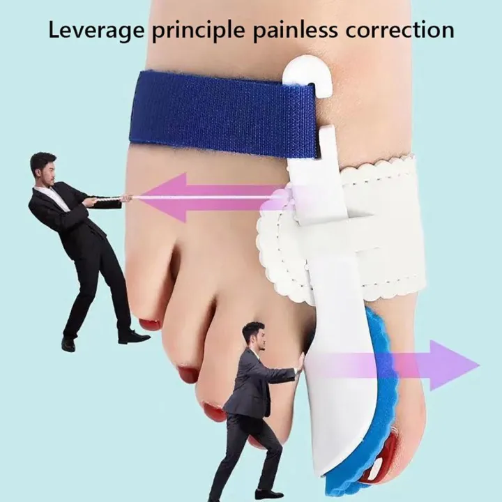 2pcs Bunion Corrector for Women Universal Female Toe Splints Toe Separators for Overlapping Big Toe