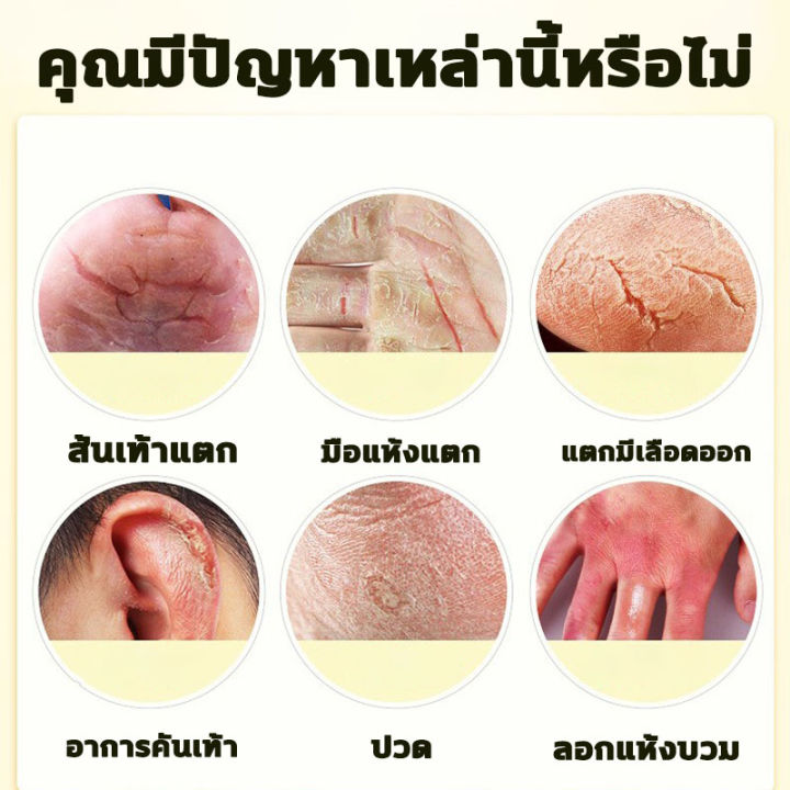 aichun-ครีมทาส้นทาแตก-100ml-ครีมทาเท้าแตก-เหมาะสำหรับส้นเท้าแตก-ผิวแตก-บำรุงผิว-ครีมทาส้นเท้าแตก-ซ่อมแซมผิวหนังแตก-ทาผิวเท้าแตก-ครีมส้นเท้าแตก-ครีมทาส้นเท้า-ครีมทาเท้า-ส้นเท้าแตก-ดูแลเท้า-foot-cream