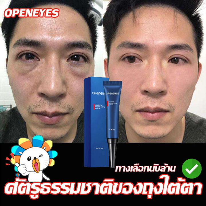 ยอดขายอันดับ1-openeyes-อายครีม-บรรเทารอยหมองคล้ำและอาการ-ครีมทาใต้ตาดำ-15g-ถุงใต้ตา-ตา-ริ้วรอยรอบดวงตา-ความหมองคล้ำ-ขาดแคลนน้ำ-แห้งขอด