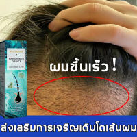 ?บอกลาหัวล้าน?สเปรย์ปลูกผม เร่งผมขึ้นใหม่ เร่งผมยาวไว ป้องกันผมร่วง ป้องกันผมร่วงอย่างมืออาชีพ แก้ปัญหาผมร่วง ลดผมร่วง(น้ำยาใส่ผม ยาปลูกผม น้ำยาปลูกผม น้ำยาเร่งผมยาว เซรั่มปลูกผม ปลูกผมเร่งด่วน ปลูกผม ยาปลูกผมของแท้ ยาปลูกผมผู้ชาย)Hair Growth