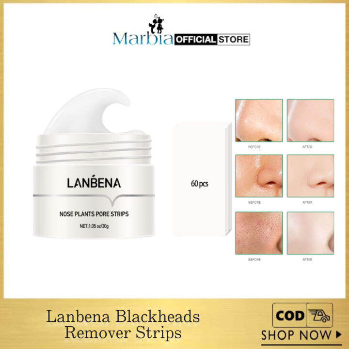 LANBENA Aloe Vera Blackhead Remover Strips Pore Minimizer Acne Treatment Deep Cleansing Nose