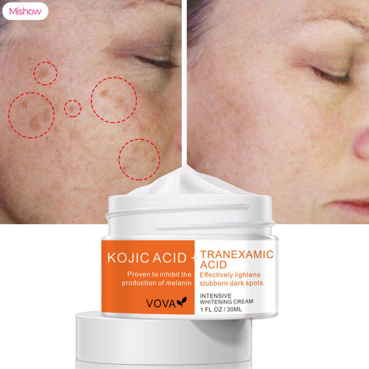 Mishow Kojic Acid Tranexamic Acid Face Cream Remove Melasma Acne Spot