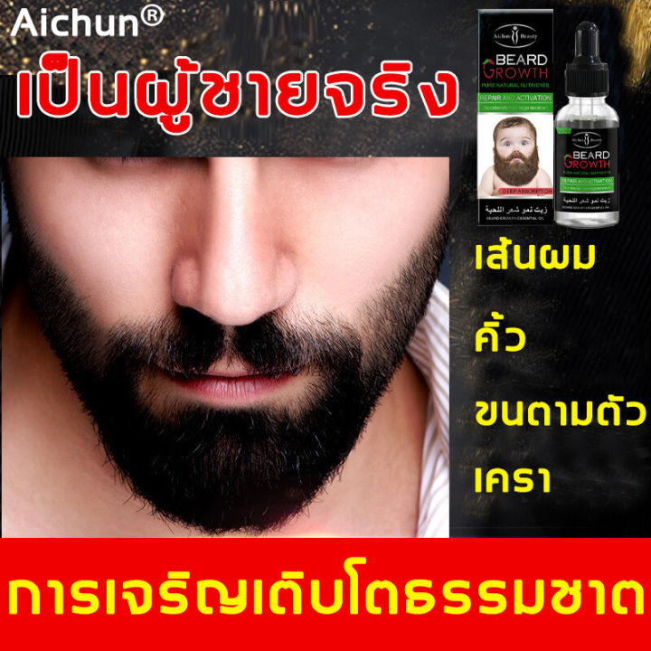 เซรั่มปลูกผม-30g-น้ำยาปลูกหนวด-เร่งเครา-จอน-คิ้ว-ปลูกคิ้ว-น้ำยาบำรุงหนวด-ปลูกหนวด-น้ำยาปลูกคิ้ว-เซรั่มปลูกคิ้ว-ปลูกเครา-น้ำยาปลูกผม-เซรั่มปลูกผมดก-ปลูกคิ้วดกดำ-ปลูกหนวดของแท้-น้ำยาเร่งหนวด-นํ้ายาปลูกค