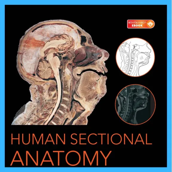 PRINTED] Human Sectional Anatomy Atlas of Body Sections, CT and