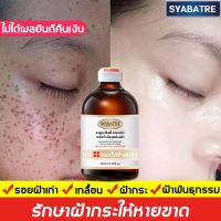 ทําให้จุดดําหายไปหมด ！SYABATRE ครีมทาฝ้า 100ml ลดจุดด่างดภายใน1สัปดาห์ ลดฝ้ากระให้หายขาด ครีมทาฝ้ากระ ครีมฝ้ากระ ครีมรักษาฝ้า ครีมทาฝ้าหนาๆ ครีมลดฝ้า ครีมกระไวท์เทนนิ่ง ครีมทาหน้า ครีมทาฝ้าลึก ครีมแก้ฝ้าลึก ครีมไวท์เทนนิ่ง ครีมหน้าขาวใส ครีมถาหน้าขาว