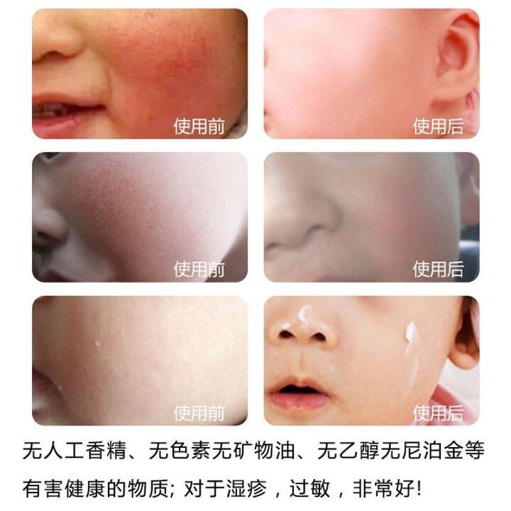 south-koreas-authentic-imported-palace-secret-policy-childrens-baby-baby-moisturizing-cream-autumn-and-winter-moisturizing-moisturizing-refreshing-moisturizing