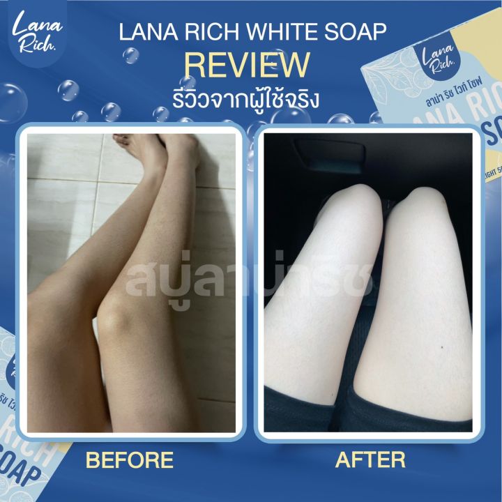 พร้อมส่ง-สบู่ลาน่า-ริช-lana-rich-white-soap-ลา-น่า-ริช-เร่งขาว-ขาวเเรงง-สบู่ผิวตัว-ผสมอาร์บูติน-และ-กลูต้า-ลดรอยแตกลาย