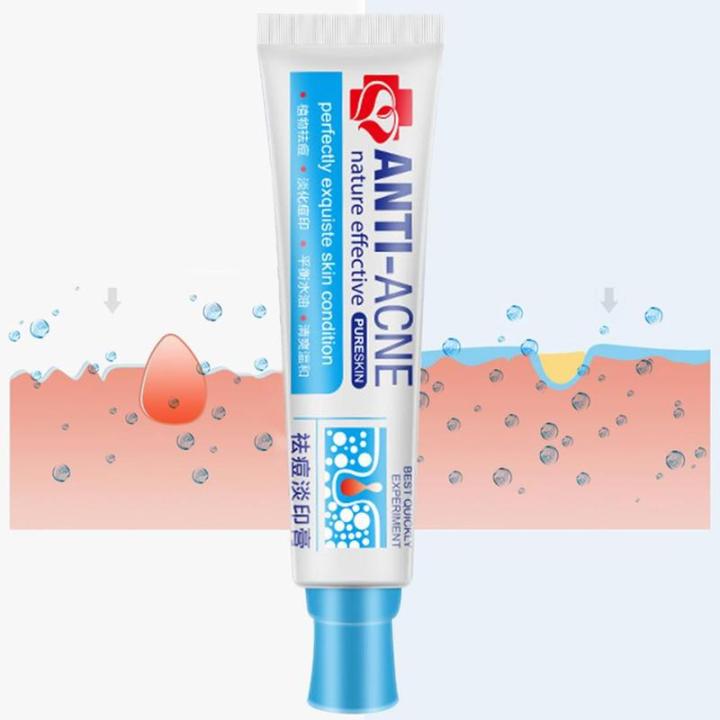 uclanka-traditional-chinese-medicine-acne-shrinking-pore-whitening-gel-whitening-moisturizing-acne