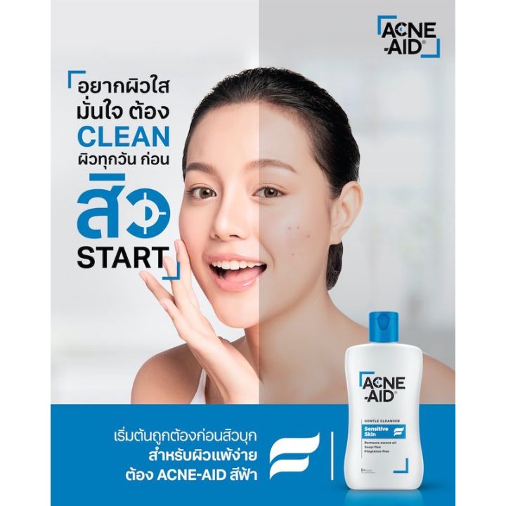 acne-aid-gentle-cleanser-100-ml-สีฟ้า-สบู่เหลวล้างหน้า-เหมาะสำหรับผิวแพ้ง่าย-ที่มีแนวโน้มเป็นสิว