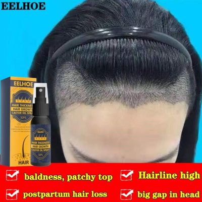50ML EELHOE Hair Grower Spray Men And Growth Anti-hair Loss Anti-balding