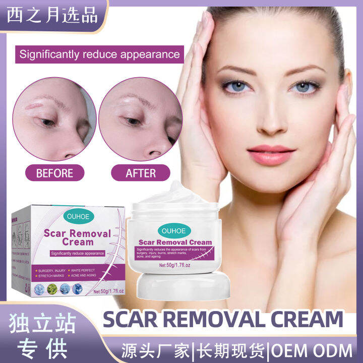 OUHOE Scar Repairing Cream Fade Scar Surgery Scar Repair Trauma Smooth ...