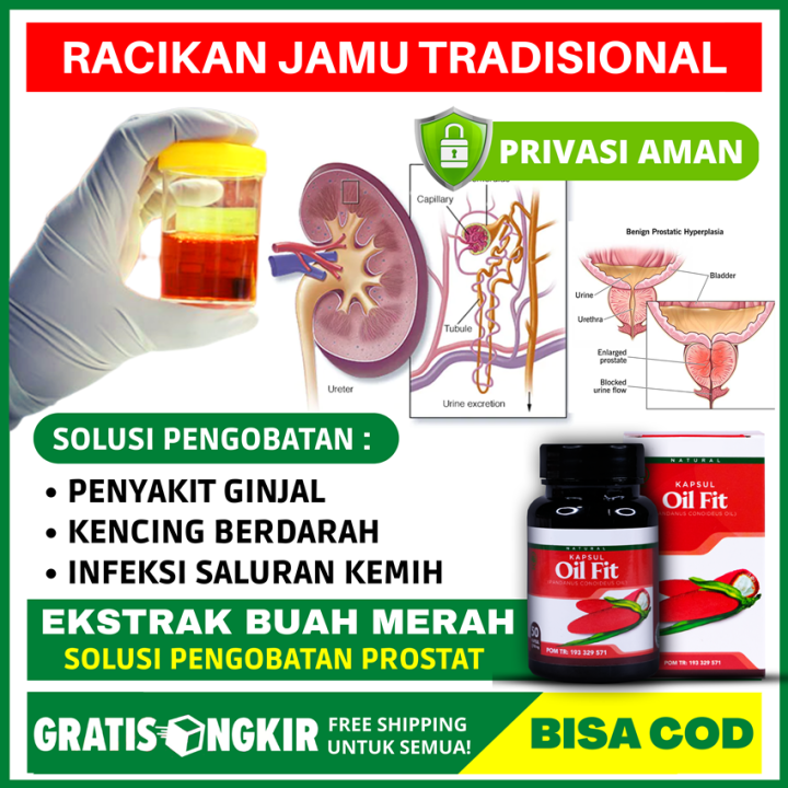 Obat Kencing Darah Pria Wanita Hematuria Kencing Berdarah Infeksi