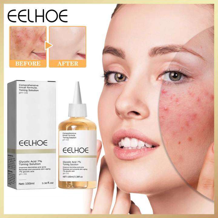 Eelhoe Moisturizing Whitening Glycolic Acid Shrink Pores Pimple Repair