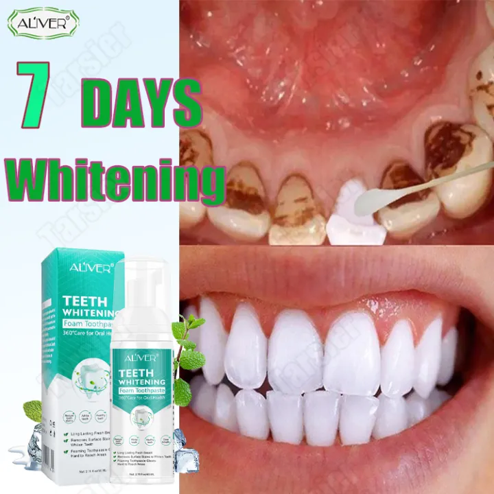 Teeth Whitening Mousse Foam Toothpaste Deep Cleaning Stain Remover 45ml