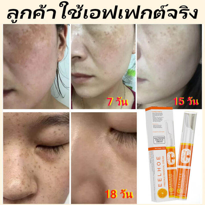 vit-c-เซรั่มหน้าใส-เซรั่มลดฝ้ากระ-ครีมทาฝ้ากระ-ครีมทาหน้าใส-ครีมรักษาฝ้า-ฝ้ากระจางลง-ให้ความชุ่มชื้น-ไวท์เทนนิ่ง-freckle-serum