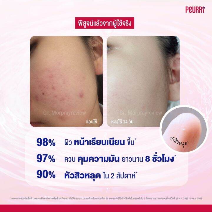 peurri-acne-cleanser-เจลล้างหน้า-250-ml