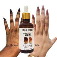 【CW】 Instant Dark Knuckles Whitening Essential Oil Remove Hand Leg Foot Dark Knuckles Eraser Elbow Knee Beauty Skin Care Serum Unisex