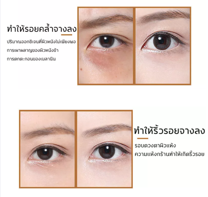 จัดส่งทันที-อายครีม-ครีมดูแลรอบดวงตา-20g-ครีมทาขอบตาดำ-ครีมทารอบดวงตา-อายครีมทาใต้ตา-ลดริ้วรอยรอบดวงตา-ครีมบำรุงใต้ตา-ซึมซับสู่ผิวหนังอย่างรวดเร็ว-กระชับรอยตีนกา-ครีมลบถุงใต้ตา-lfspring-eye-cream