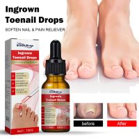 ZZOOI 1/2/3Pcs Ingrown Toenail Treatment Serum Nail Correction Recover Oil Pain Reliever Nail Softener Trim with Ease Oil Feet Care