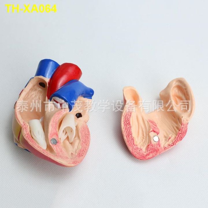 anatomy-model-j33208-เครื่องมือสอนธรรมชาติขนาดใหญ่-1-1-โมเดลการสอนกายวิภาคของหัวใจมนุษย์