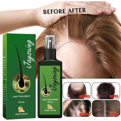 【cw】 120ml Hair Lotion Hair Growth Serum Essence Oil Hair Loss Treatment Growth Hair For Men Women Thailand Anti Hair Loss Spray T3m2 ！