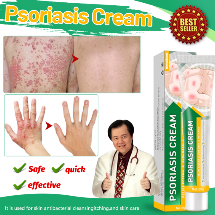 atoderma cream original eczema treatment cream ointments for skin ...