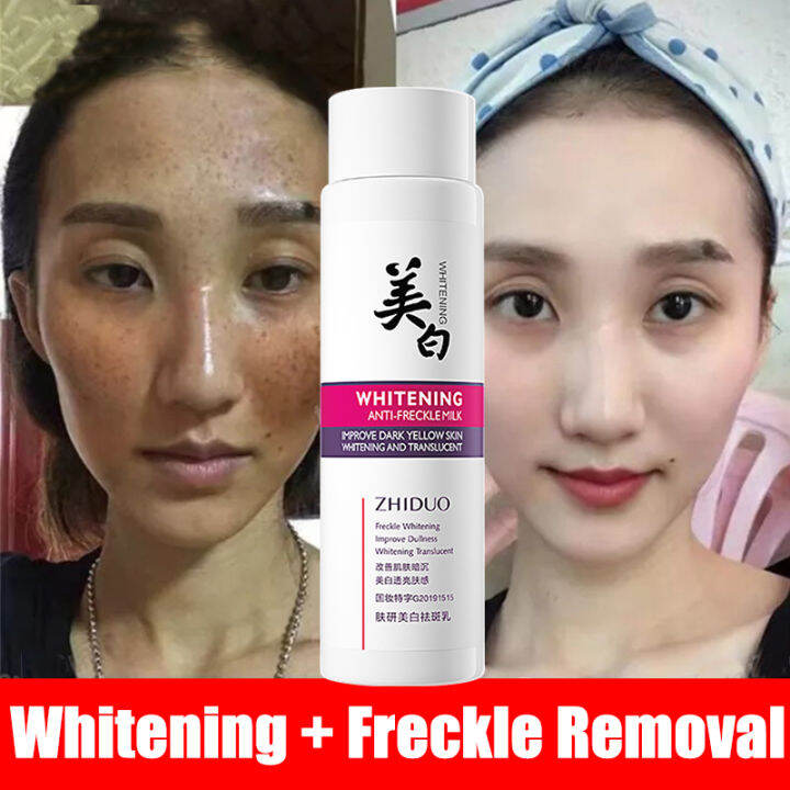 【3 Days Effective】Effective Whitening Freckle Cream Original ...