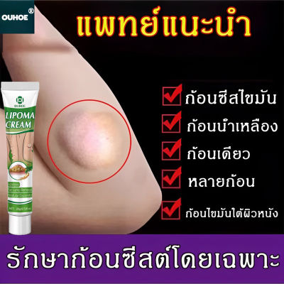 Lipoma removal cream ครีมก้อนเนื้องอกไขมัน ครีมทาเนื้องอกไขมันกำจัดปัญหาใต้ผิวหนัง ก้อนไขมันแข็ง เนื้องอกไขมัน สมุนไพรกำจัด ก้อนเนื้อใต้ผ