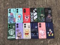 SAMSUNG เคสลายการ์ตุน กันกล้องโครเมียม เคสซัมซุง J7 J4PLUS S23ULTRA A34(5G) A54(5G) A24 A33 A14 A51 A71 A12 A31 A73 A03 A03S A02S A02 A9 A9PRO A13(4G) A13(5G) A10 A10S A22(5G) A20 A30 A50 A04 A23