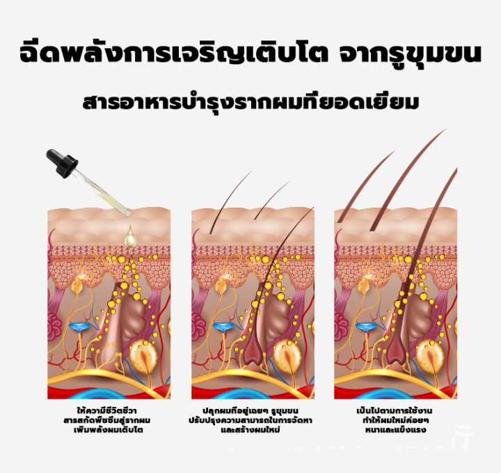 lanemay-hair-serum-เซรั่มบำรุงผม-30ml-1ขวด-เอสเซ้นส์ขิงบำรุงผม-กันร่วง-เซรั่มปกป้องผม-เซรั่มขิงปลูกผม-น้ำยาปลูกผม-บำรุงผม-เซรั่มปลูกผม-ป้องกันผมร่วง-น้ำยาเร่งผมยาว-แชมพูปลูกผมดก-เซรั่มใส่ผม-สเปรย์ปลูก