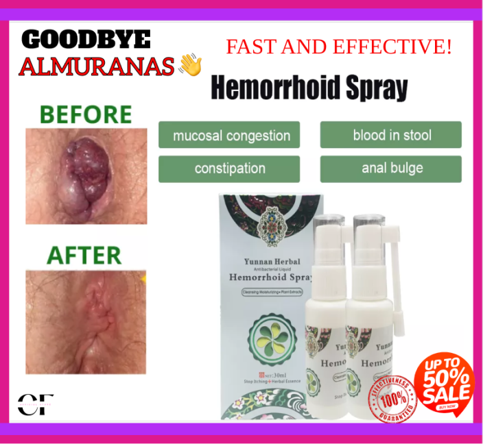 Best Seller Original Herbal Hemorrhoids Spray 100 Guaranteed Safe And Effective Treatment Of 4355