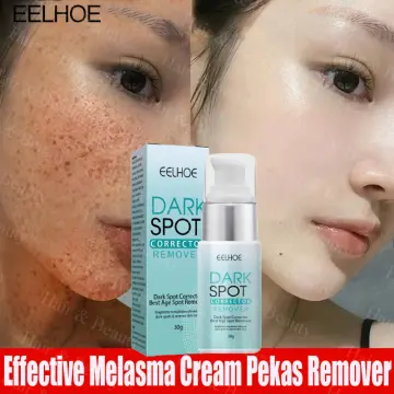 Shop Dark Spots Corrector online | Lazada.com.ph