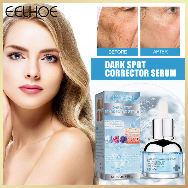 Eelhoe Dark Spot Corrector Serum Remove Lighten Melanin Freckle