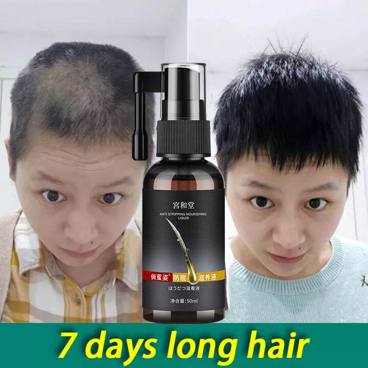【Hot selling in Japan】Hair Tonic Hair Growth Essence 50Ml Hair Growth