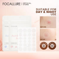 Focallure กันน้ำแพทช์สิว Blemish การดูแลบำรุงผิว Acne Repair