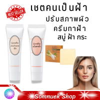 ส่งฟรี #ครีมทาฝ้า #สบู่หัวไชเท้า ครีมบำรุงผิว #ครีมทาฝ้ากิฟฟารีน ครีมบำรุงหน้า ครีมทาฝ้า กระ  ครีมทาฝ้า