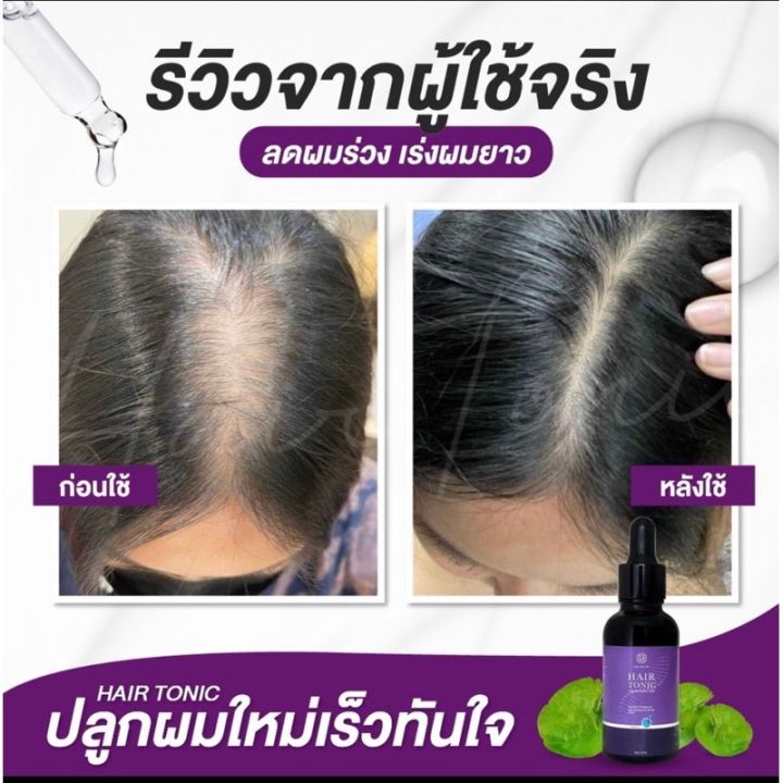 พร้อมส่ง-แฮร์โทนิค-สเปรย์ชบา-ลดผมร่วง-กระตุ้นผมเกิดใหม่-ปลูกผม-หนวด-คิ้ว-จอน-ป้องกันและบำรุงผมให้นุ่มสวย-ผมหอม