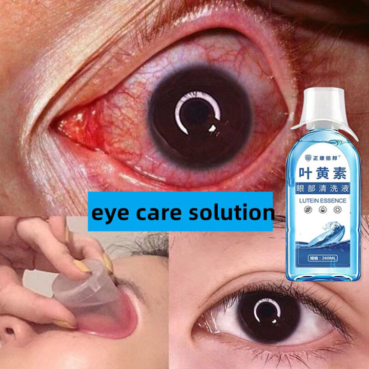 Authentic Medical Eye Wash Solution Care Liquid eyewash eye lotion Eye ...