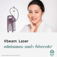 [E-Coupon] นครธน เคลียร์รอยแดง รอยดำ ที่เกิดจากสิว ด้วยเครื่อง Vbeam Laser 120 Shots*