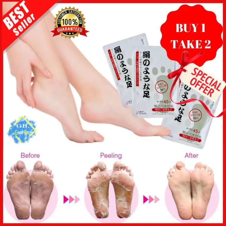 BUY 1 TAKE 2 ORIGINAL Japan Foot Peeling Renewal Mask Remove Dead