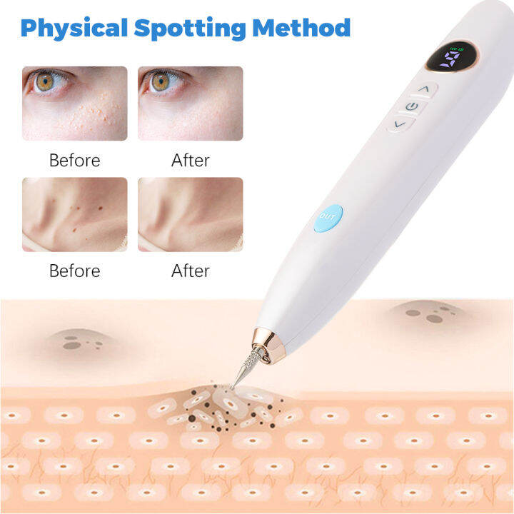 9-mode-plasma-pen-freckle-remove-pen-wart-remover-mole-tattoo-remover-instruments-skin-tag-removal-spot-cleaner-beauty-care-tool