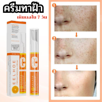 ปากกาเมลานิน ครีมทาฝ้า ครีมลอกฝ้า ครีมแก้ฝ้าถาวร ครีม แก้ ฝ้า กระ vitamin c ครีมทาฝ้าหนาๆ ครีมทาฝ้า ครีมฝ้ากระลึก กำจัดจุดด่างดำ