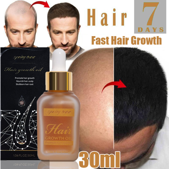 AMEIZII Hair Grower for Women Effective Oil 30ml Minoxidil Hair Grower ...